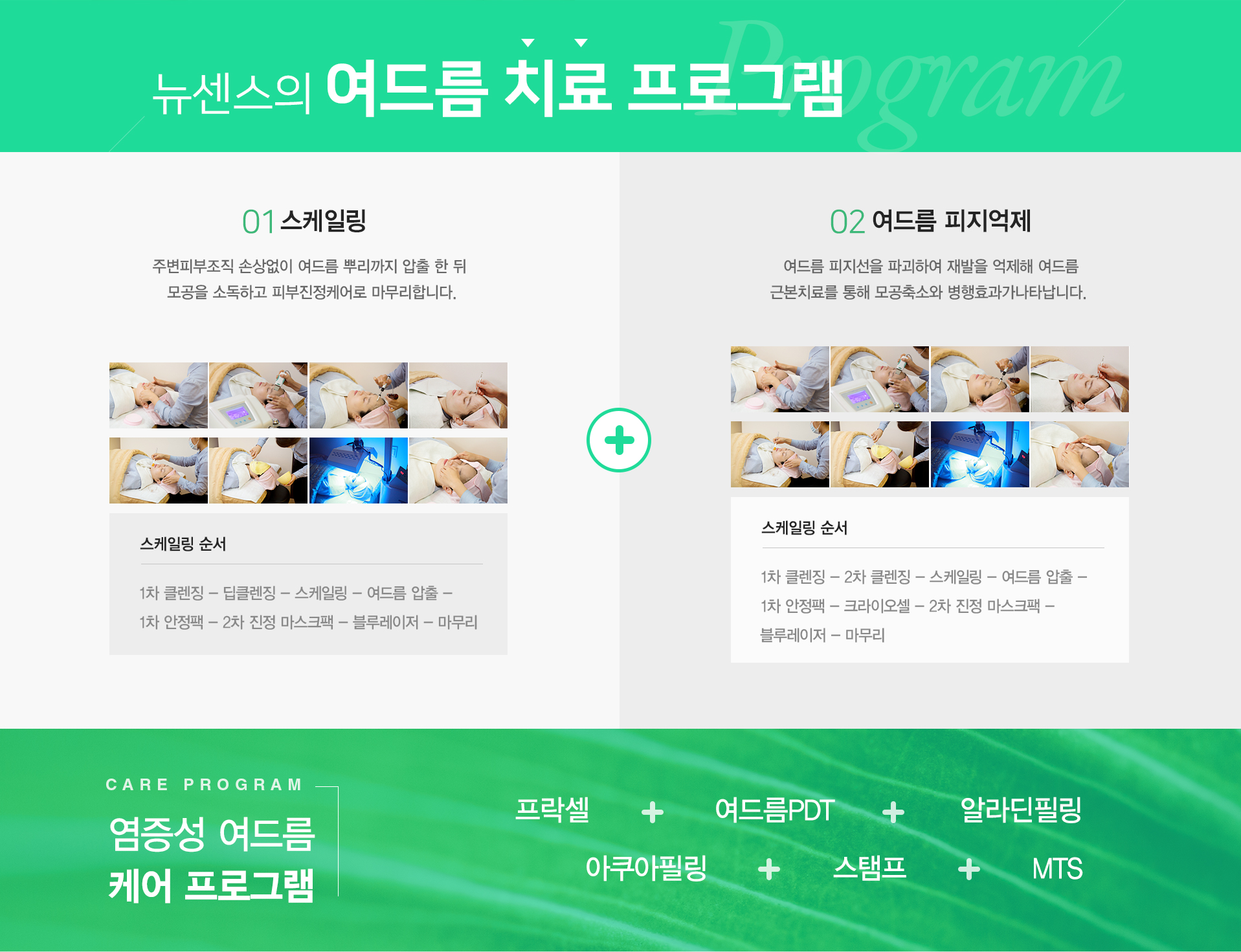 newsense-image